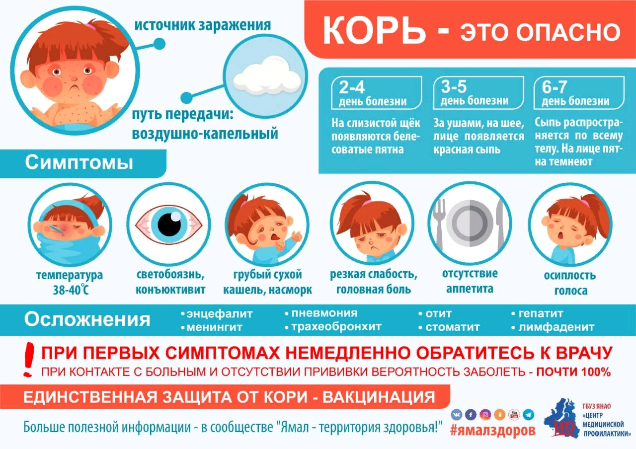 Корь - симптомы болезни, профилактика и лечение кори, причины заболевания и его диагностика на eurolab