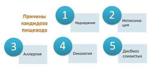 Рецидивирующие грибковые заболевания половых органов