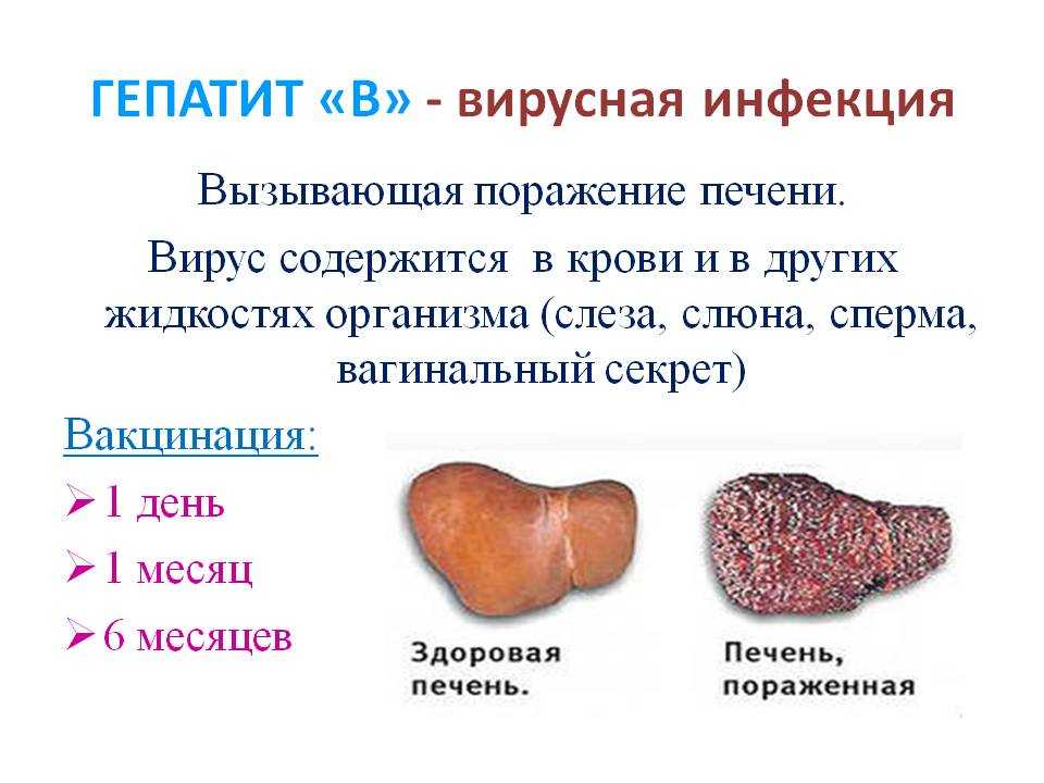 Вирусный гепатит с клиническая картина