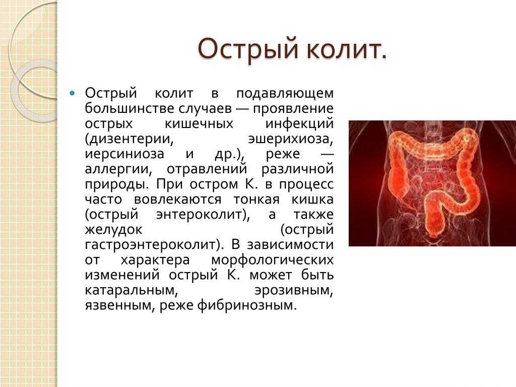 Заболевания желудочно-кишечного тракта