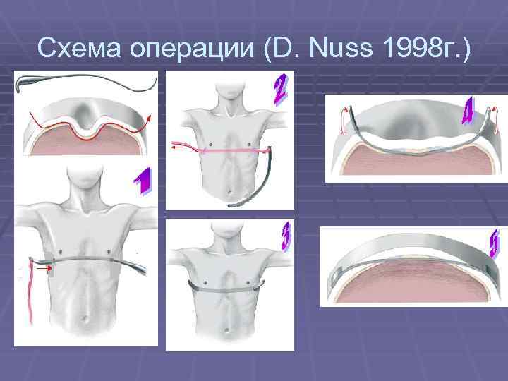 Эмбриология груди и врожденные пороки развития – женская грудь