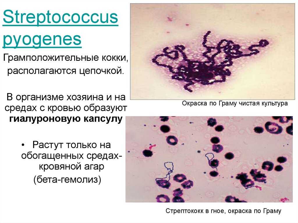 Стрептококки какие. Патогенные кокки. Грамположительные кокки. Грамположительные кокки стрептококки. Грамположительные кокки микробиология. Стрептококки окрашивание по Граму.