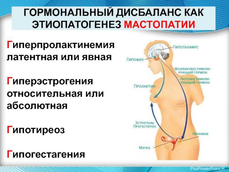 Гормональный сбой. Гормональный дисбаланс. Гиперпролактинемия. Гормональный дисбаланс симптомы. Нарушения женских половых гормонов.