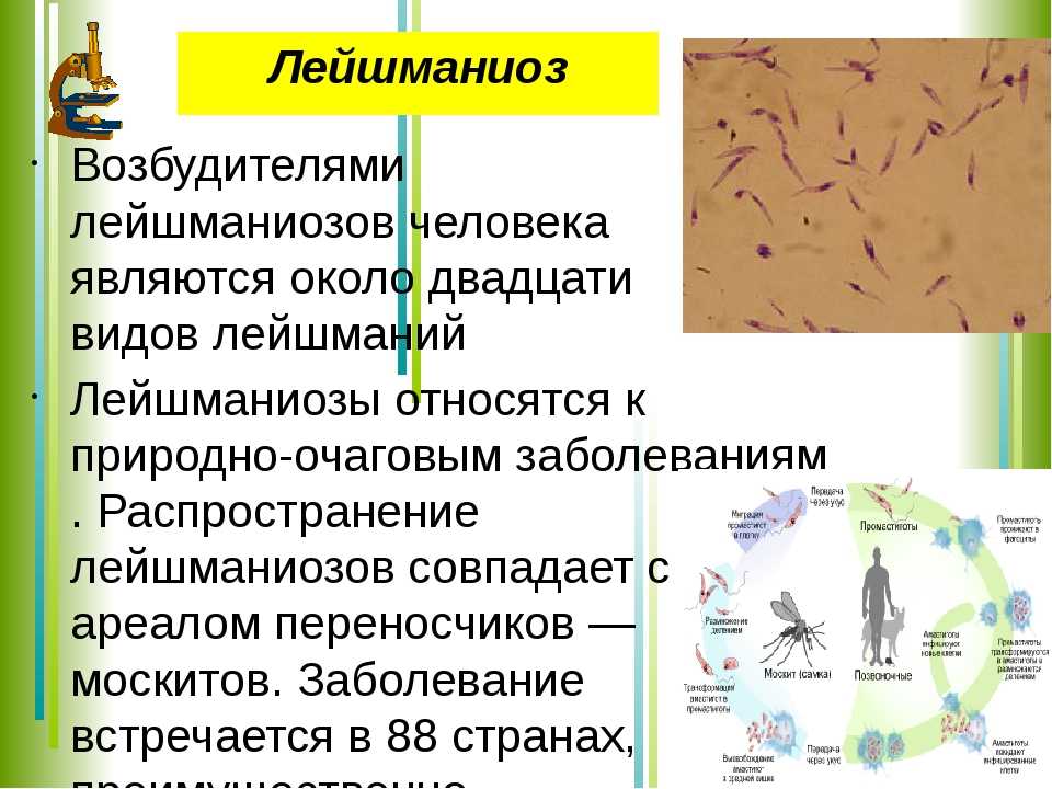 Лейшманиоз