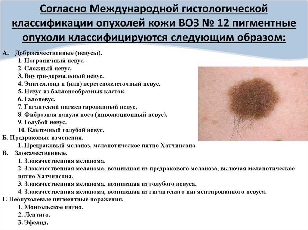 Опухоль уха - симптомы болезни, профилактика и лечение опухоли уха, причины заболевания и его диагностика на eurolab