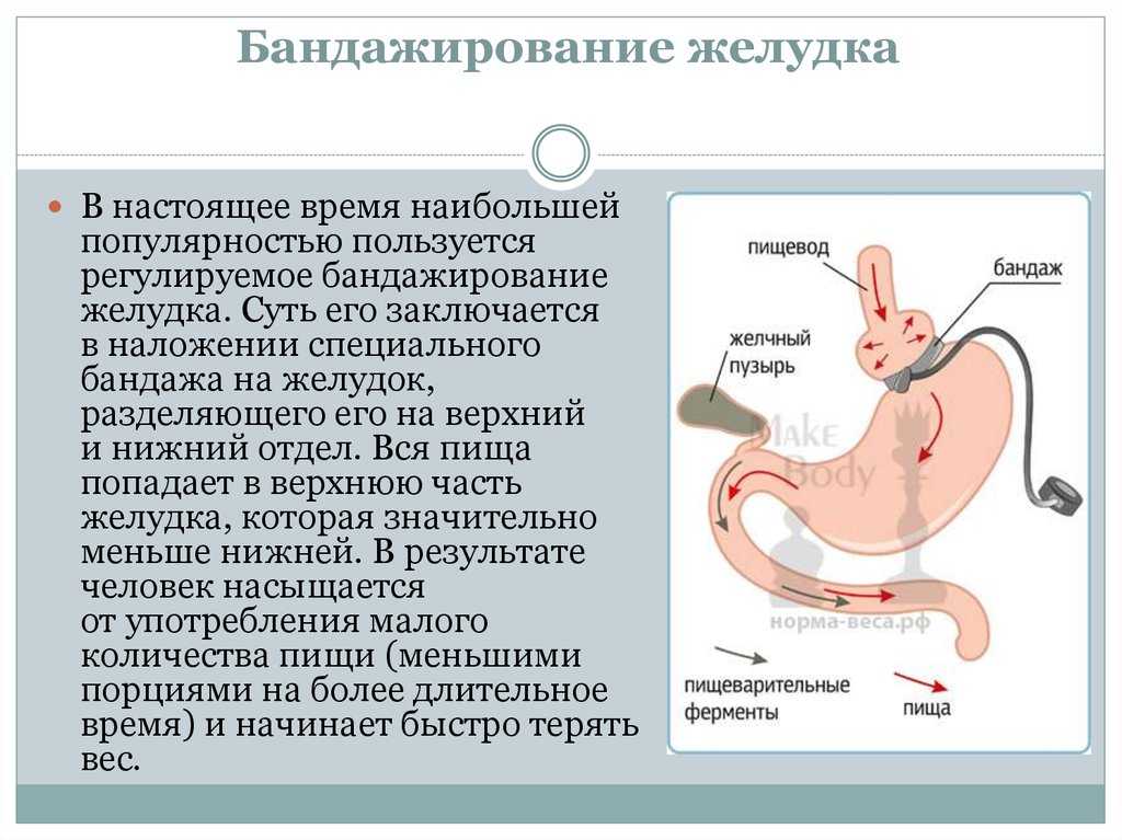 Подагра: симптомы и методы лечения. диета и препараты при подагре.