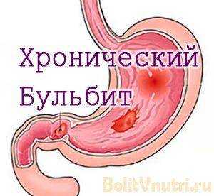 Гастроэзофагеальная рефлюксная болезнь: новый подход к причинам и лечению