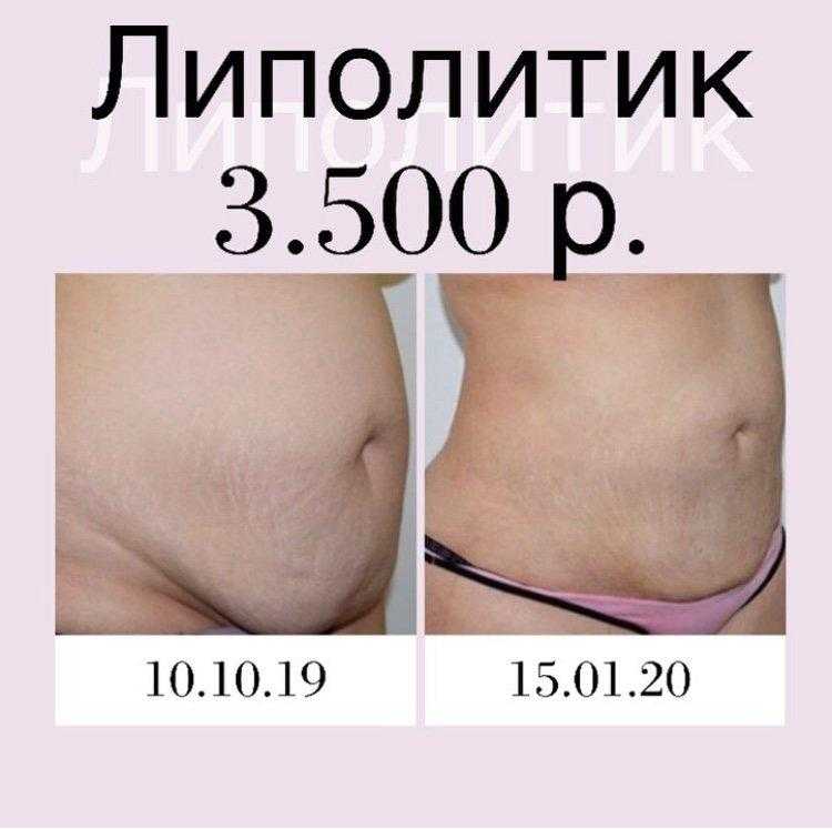 Диета для похудения с молочной сывороткой