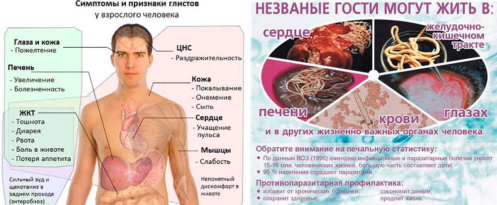 Глистные инвазии