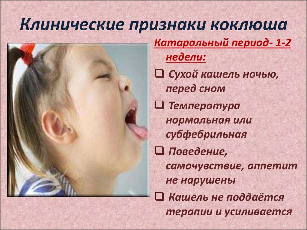 Коклюш у детей: симптомы, лечение и профилактика