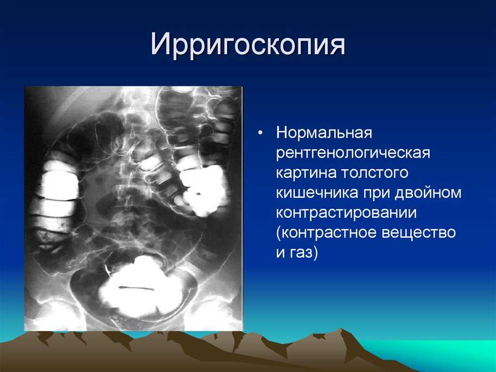 Бариевая комната это