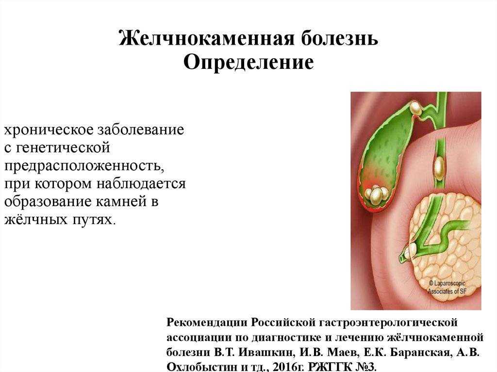 Деформация желчного пузыря