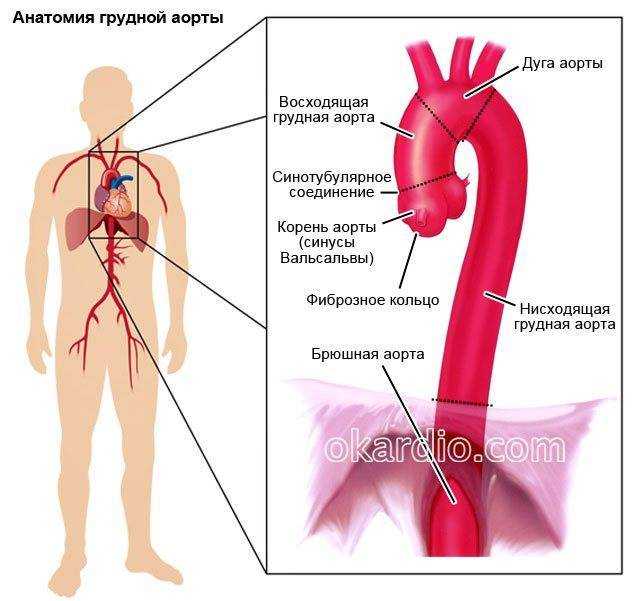 Аневризма аорты