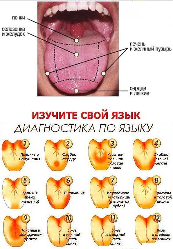 Картинки на языке