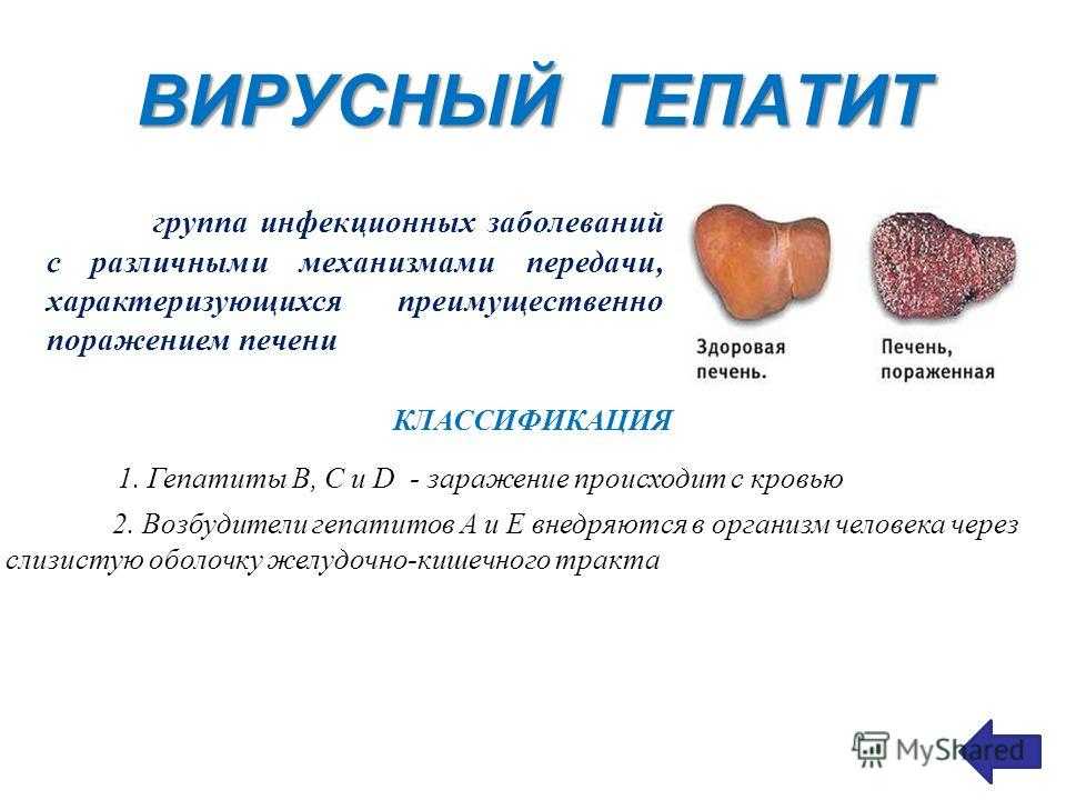 Гепат. Печень при вирусном гепатите. Вирусные болезни печени (гепатит).. Вирусный гепатит (болезнь Боткина).