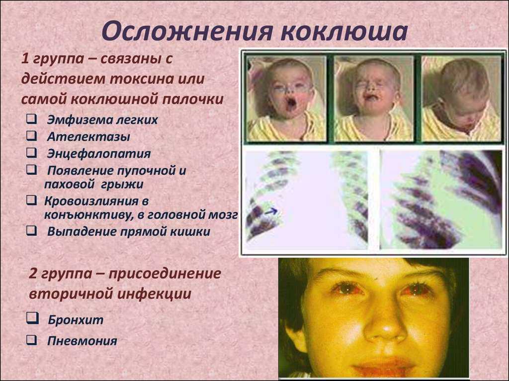 Интоксикация: стадии, причины и лечение | университетская клиника