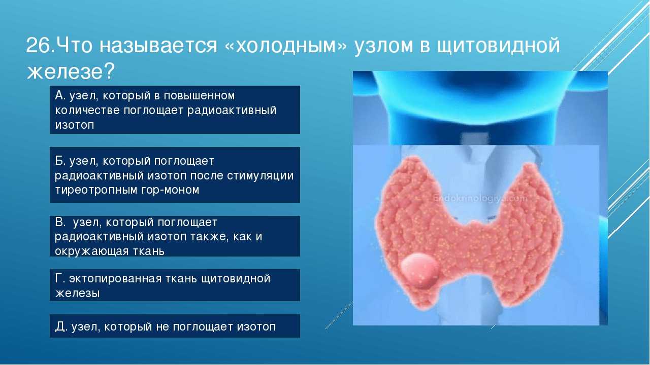Щитовидная железа узел в левой доле. Узлы в щитовидной железе. Узлы на щитовидной железе железа.