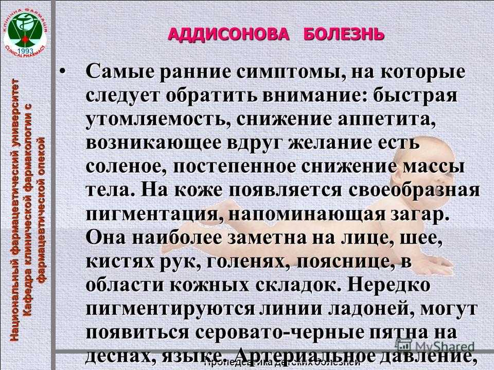 Хроническая надпочечниковая недостаточность