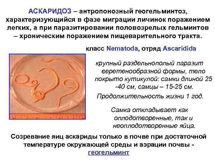 Глистные инвазии