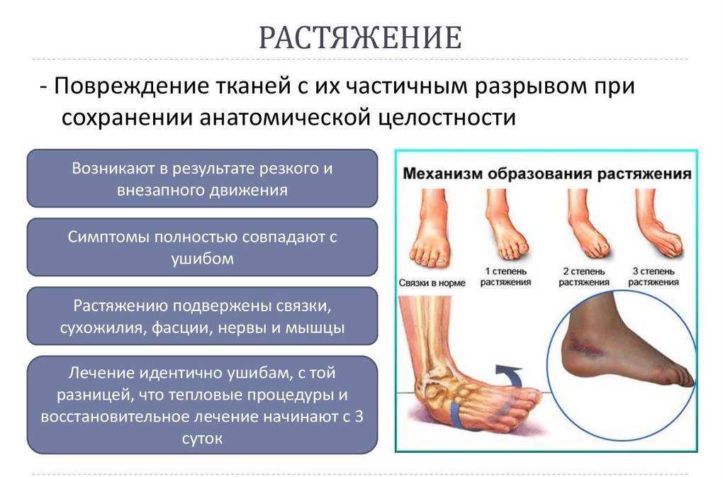 Связки голеностопного сустава: строение, растяжение, разрыв, лечение | повреждение, травма лодыжки