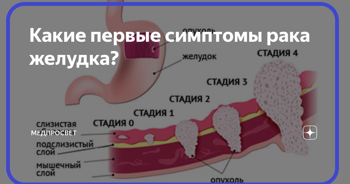 Рак губы: симптомы, первые признаки, как выглядит начальная стадия - medside.ru