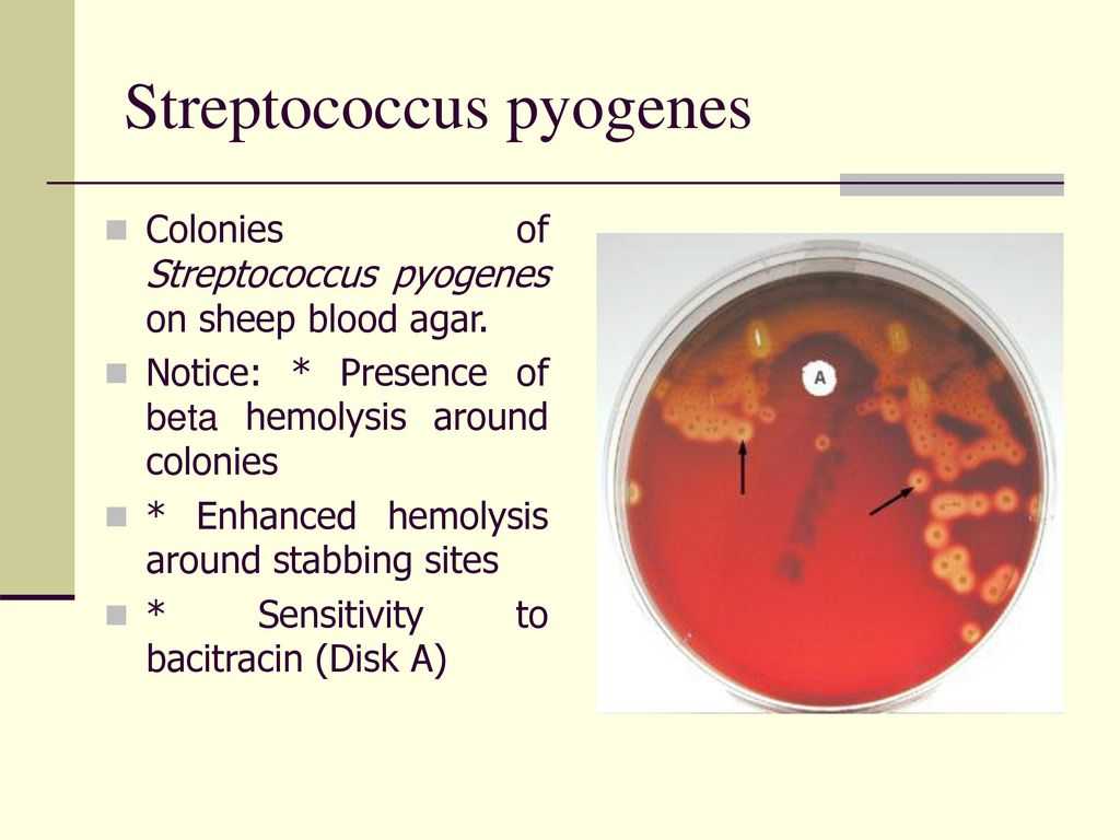 Стрептококки у женщин лечение. Стрептококк пиогенес 10 в 4 степени. Синегнойка Streptococcus pyogenes. Streptococcus pyogenes тропность.
