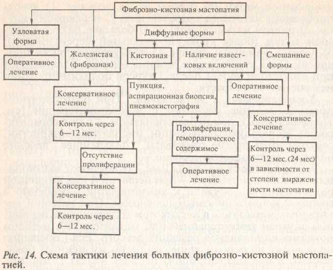 Мастопатия в молочных железах