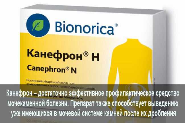 Камни в почках: почему образуются и как лечить?