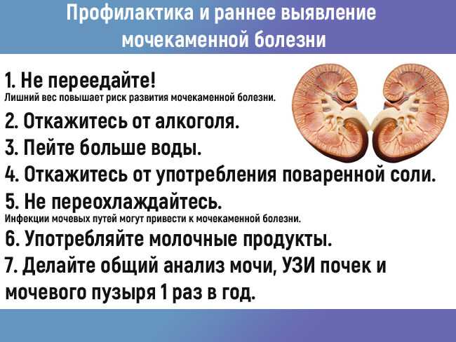 Мочекаменная болезнь: виды камней, симптомы, диагностика
