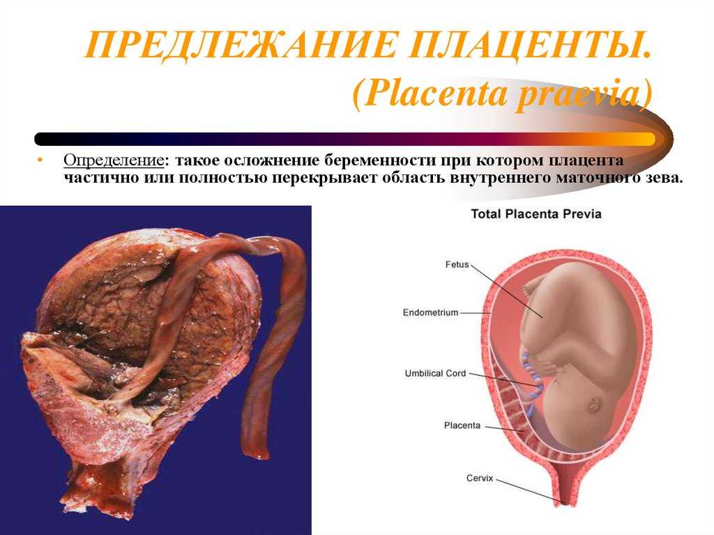 Развитие ребенка по неделям беременности — что происходит с эмбрионом | аборт в спб