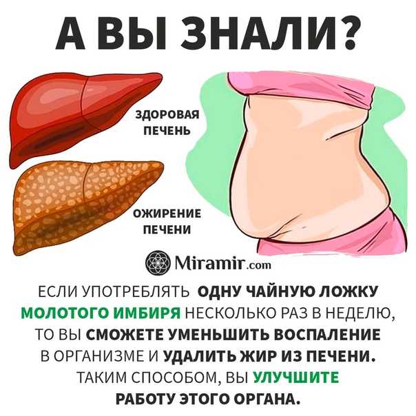 Донор жира. Ожирение печени гепатоз печени. Жировой гепатоз 1 степени. Жировой гепатоз печени симптомы. Жировой гепатоз 2 степени.