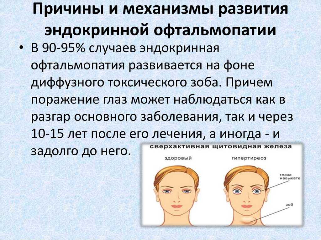 Анестезиологическое участие в операциях орбитальной декомпрессии для лечения эндокринной офтальмопатии