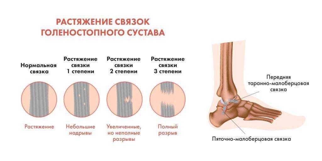 Причины травм опорно-двигательного аппарата спортсменов с точки зрения биомеханики
причины травм опорно-двигательного аппарата спортсменов с точки зрения биомеханики