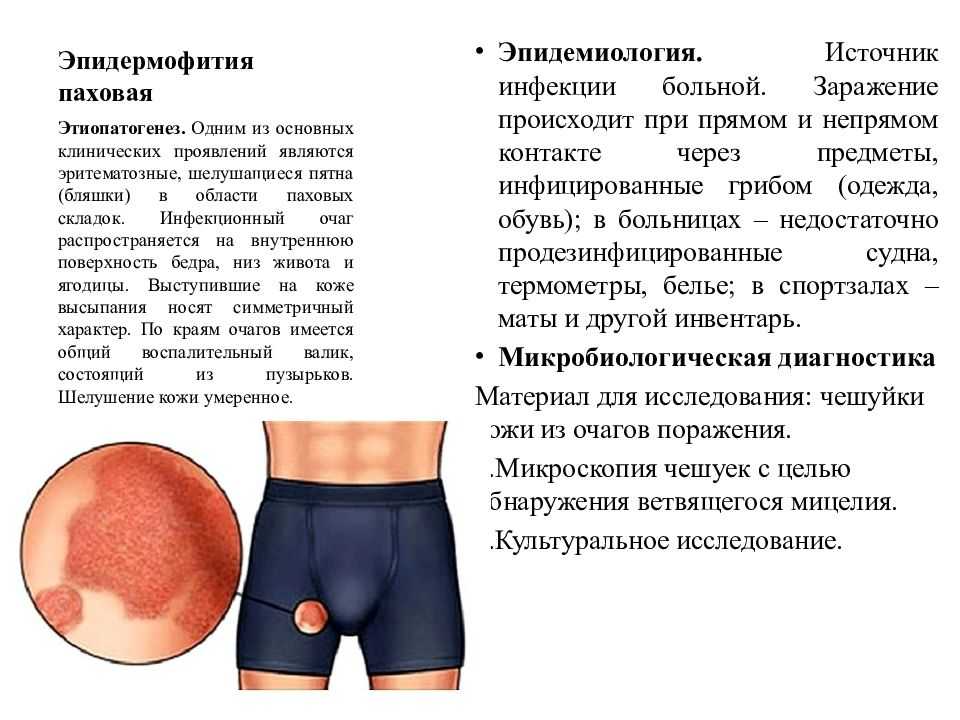 Пахово-промежностный гипергидроз: симптомы и причины повышенной потливости, как лечить - клиника "отражение"