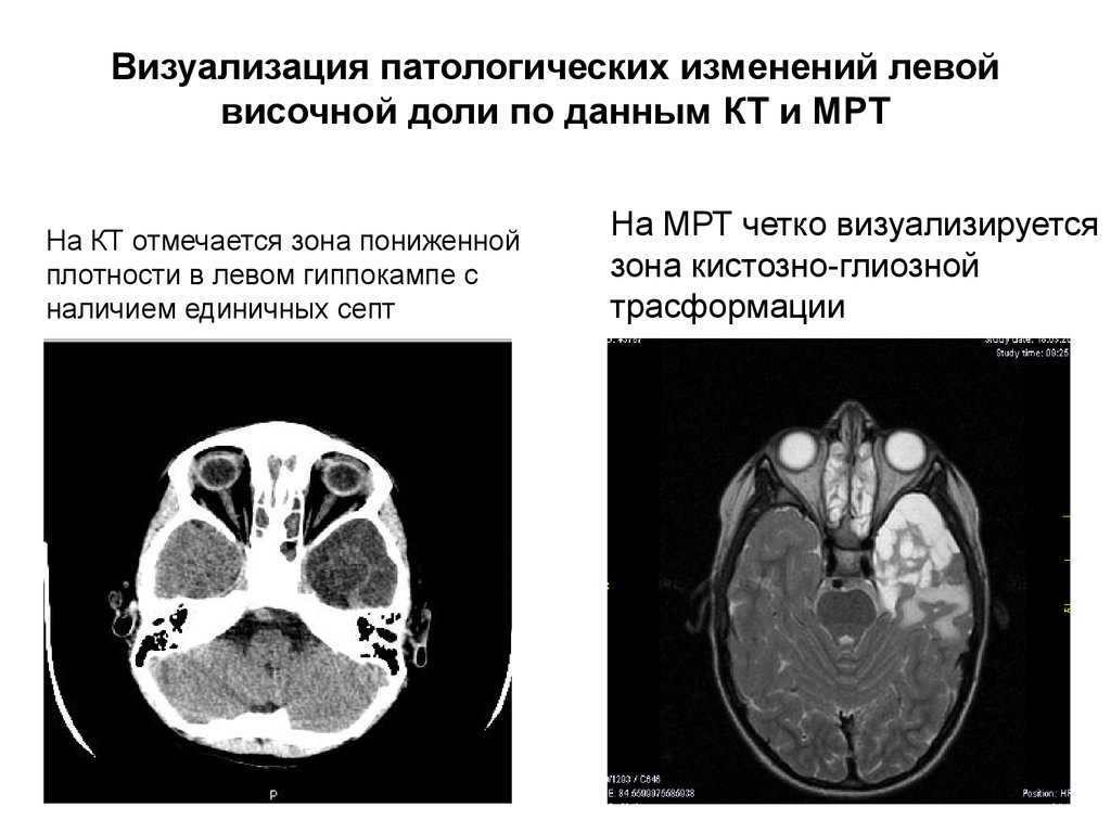 Изменения головного