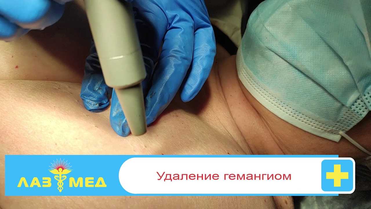 Опухолевые заболевания кожи и слизистых оболочек