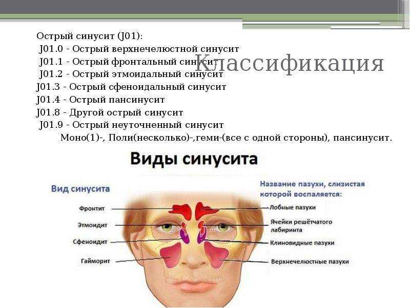 Острый риносинусит » библиотека врача